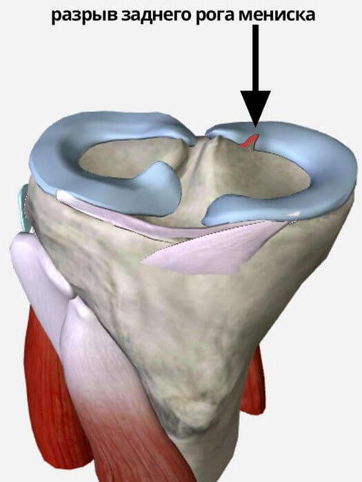 ������ �������