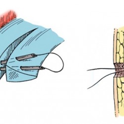 ��� ������� � ��� � ����������